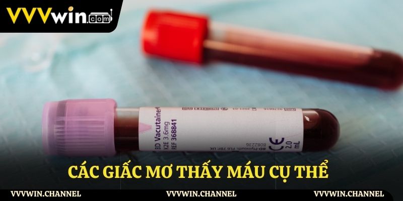 Ý nghĩa chi tiết của những giấc mơ thấy máu Ý nghĩa chi tiết của những giấc mơ thấy máu